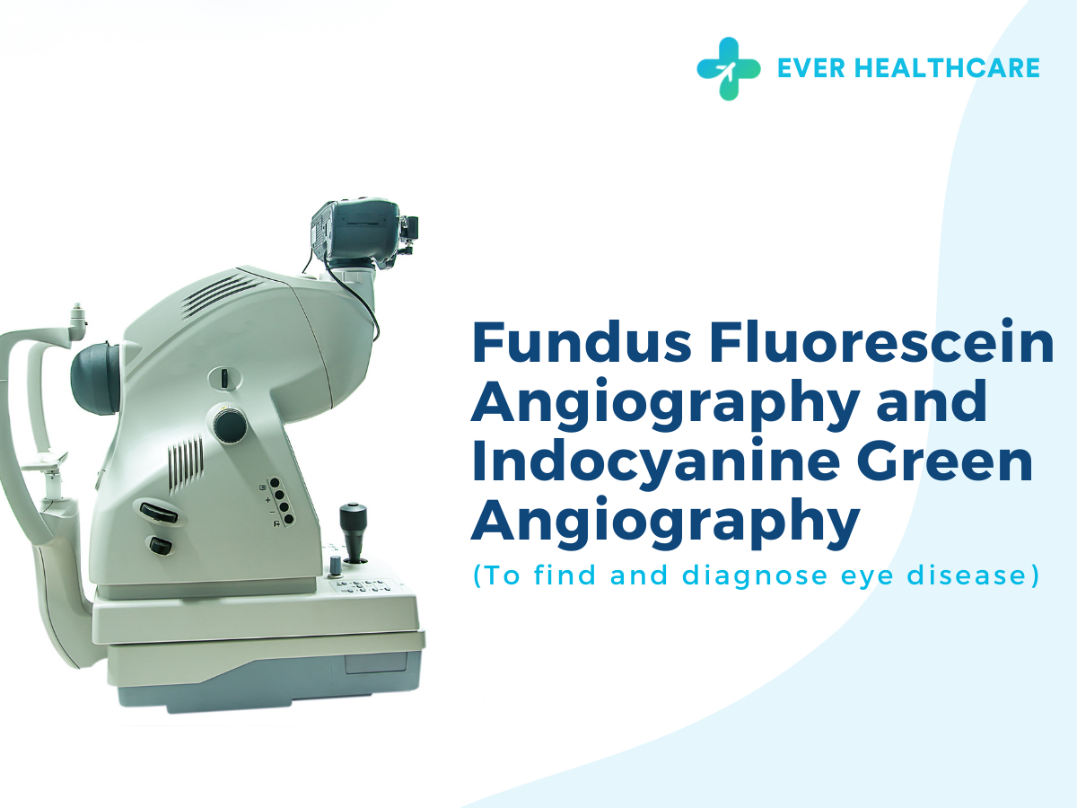 Fundus Fluorescein Angiography (FFA) and Indocyanine Green (ICG